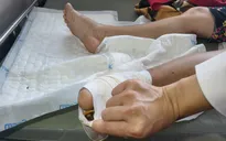 Các biến chứng nguy hiểm của bệnh đái tháo đường type 2