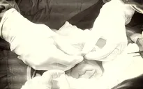 Cứu sống bé trai bị vỡ dị dạng mạch máu ruột non