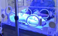 Sinh non - Những điều cần biết