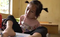 Những “bông hoa trên đá” đầy nghị lực, lạc quan