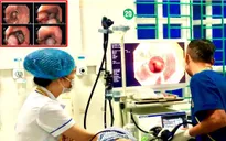 Cấp cứu bệnh nhân xuất huyết tiêu hóa nặng do vỡ tĩnh mạch thực quản