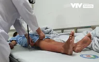 Cảnh báo sốt xuất huyết đang trong giai đoạn cao điểm