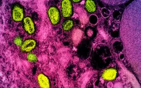 Bệnh đậu mùa khỉ được đổi tên thành "mpox"