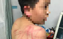 Khởi tố kẻ bạo hành con ruột dã man ở Đà Lạt