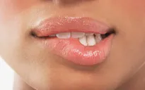 Những đốm đen xuất hiện trên môi có ý nghĩa gì?