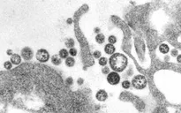 Anh ghi nhận 3 trường hợp mắc sốt Lassa mới, trong đó có 1 ca tử vong