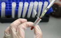 Người phụ nữ đầu tiên trên thế giới khỏi HIV sau khi được cấy ghép tế bào gốc