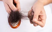 Bác sĩ tư vấn cách khắc phục rụng tóc hậu COVID-19
