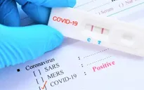 F0 có cần test nhanh hằng ngày?