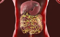 Sự quan trọng của chăm sóc sức khỏe đường ruột và chế độ ăn giàu chất xơ