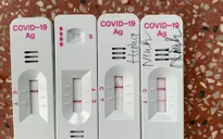 Những ai dễ tái nhiễm và có thể bị nặng hơn nếu nhiễm COVID-19 trở lại?