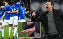 Everton thắng kịch tính Newcastle, Lampard ăn mừng đến... gãy cả ngón tay