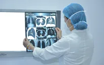Khám hậu COVID-19 lần đầu, bệnh nhân phát hiện rối loạn đông máu, tổn thương phổi