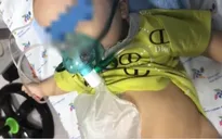 Cứu sống bé 5 tháng tuổi mắc COVID-19 gây viêm thanh quản cấp, suy hô hấp nặng