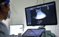Không được mua bán trang thiết bị y tế khi chưa có giá kê khai