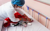 Xông mũi họng để phòng COVID-19, bé trai 6 tháng tuổi bị bỏng, nhiễm trùng máu