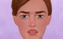 Điều gì gây ra các nếp nhăn trên khuôn mặt của bạn?