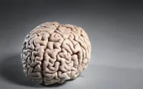 Mắc COVID-19 thể nhẹ cũng có thể dẫn đến thay đổi trong não bộ