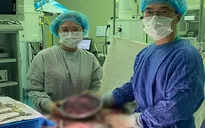 Bóc tách 10 khối u xơ tử cung lớn cho nữ bệnh nhân 35 tuổi