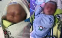 14 ngày điều trị tích cực cứu bé trai sơ sinh bị nhiễm khuẩn huyết nguy kịch