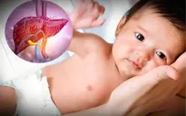 WHO nỗ lực giải mã căn bệnh viêm gan bí ẩn ở trẻ em tại 12 quốc gia