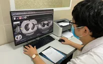 Bộ Y tế hướng dẫn các việc nên làm để tránh tình trạng "sương mù não" của hậu COVID-19