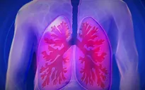 Cơ chế gien đặc biệt giúp nhiều người hút thuốc lá lâu năm không bị ung thư phổi
