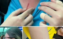 UBND TP Hồ Chí Minh chỉ đạo "nóng" xử lý vụ xô xát giữa học sinh tại trường quốc tế ISHCMC - AA