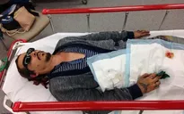 Chuyên gia nói phiên toà của Johnny Depp - Amber Heard có thể gây kích động cho những người từng bị lạm dụng