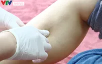 Biến chứng nguy hiểm sau khi tiêm filler làm thẳng chân