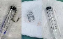Liên tiếp trẻ hóc dị vật đường tiêu hoá phải nhập viện
