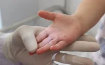 TP. Hồ Chí Minh: 95 ổ dịch sốt xuất huyết, 4 ổ dịch tay chân miệng phát sinh trong tuần qua