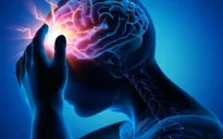 Viêm não tự miễn: Triệu chứng và phương pháp điều trị