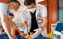 Bé 28 tháng tuổi bị dập nát bàn chân do kẹp vào cửa tự động