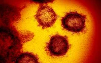 COVID-19 làm tăng chất béo cho các tế bào của cơ thể, thúc đẩy quá trình xâm nhập của virus
