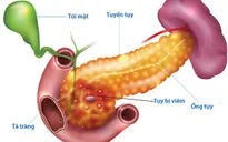 Trẻ nguy kịch vì viêm tụy cấp