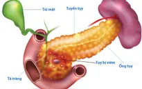 Đau bụng kéo dài, coi chừng bị viêm tụy cấp