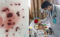 Bé mới 4 tuổi đã bị đột quỵ não, bác sĩ cảnh báo thực trạng đáng lo ngại