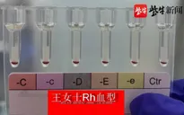 Phát hiện 2 người có nhóm ‘máu vàng’ hiếm nhất trên thế giới tại Trung Quốc