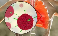 Virus Adeno mà nhiều trẻ đang nhiễm phải nguy hiểm ra sao?
