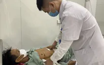 Cấp cứu bệnh nhân suy hô hấp, sốc mất máu do vết thương thấu ngực - bụng