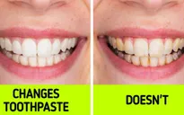 6 sai lầm khi đánh răng khiến bạn không thể có "nụ cười tỏa sáng"
