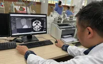 Cảnh báo các ca nhập viện gia tăng do uống rượu bia