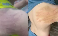 Phú Yên bác tin giáo viên đánh học sinh