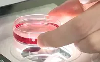 Tiến bộ mới nâng cao hiệu quả điều trị vô sinh, hiếm muộn