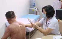 Thời tiết nồm ẩm, nhiều người mắc bệnh da liễu