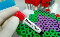 Bùng phát virus Marburg gây tử vong cao ở Tanzania