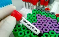 TP Hồ Chí Minh: Nâng cao cảnh giác với bệnh do virus Marburg