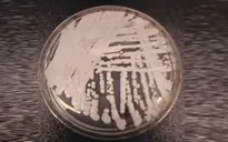 Nấm Candida auris lây lan mạnh ở Mỹ trong vòng 3 năm qua