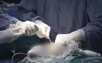 Bước đột phá trong điều trị ung thư tuyến giáp